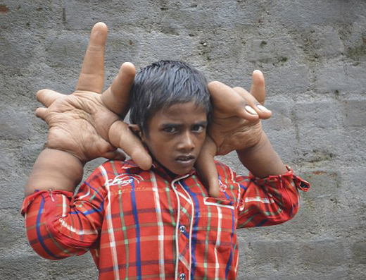 Stone hands 